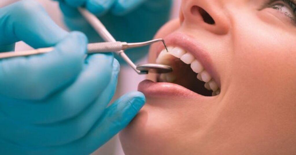 How Much is a Root Canal Without Insurance