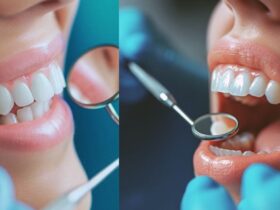 Root Canal Without Insurance