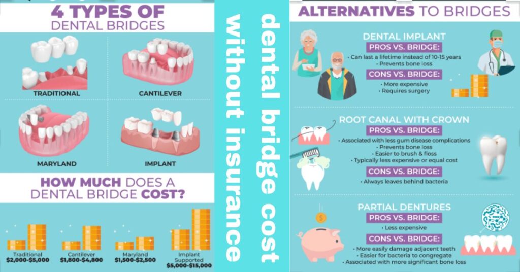 dental bridge Factors Influencing Cost insurance